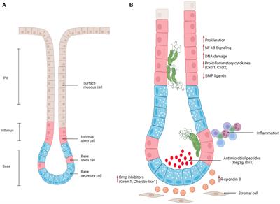 Unwelcome guests – the role of gland-associated Helicobacter pylori infection in gastric carcinogenesis